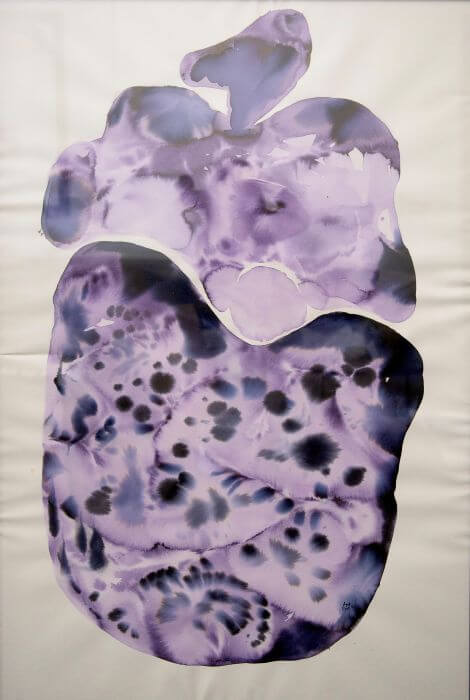 Rad 17